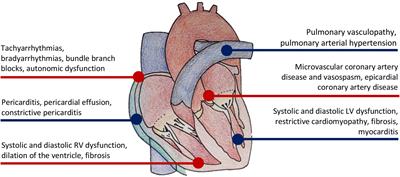 Cardiovascular Imaging for Systemic Sclerosis Monitoring and Management